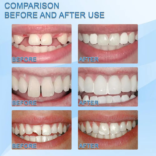 Temporary Tooth Repair Solid Gel